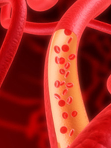 Blutgefäße/ PDF Verlinkung