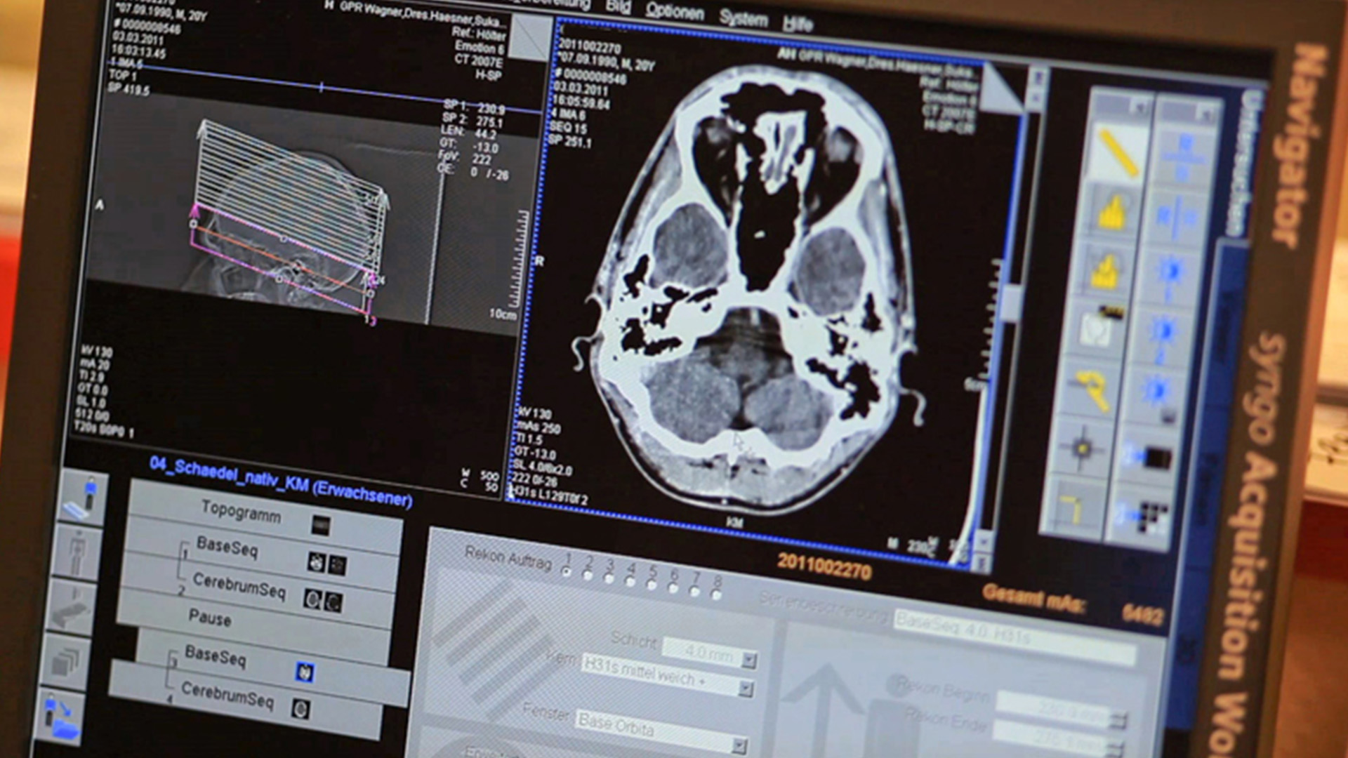 Bild Bildschirm CT Aufnahme Nuklearmedizin